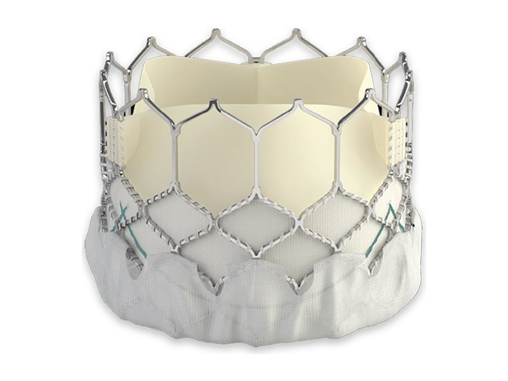 Edwards SAPIEN 3 used in the pulmonary position